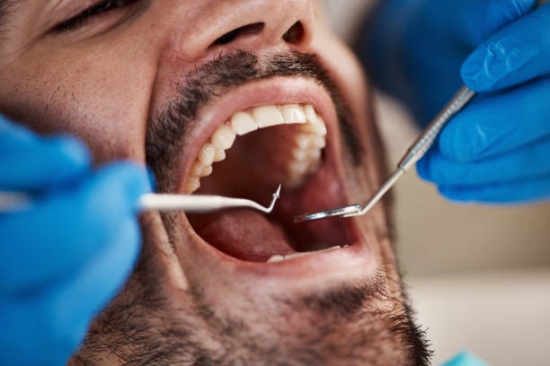 Best Mobile Emergency Dentist in Parkland, FL